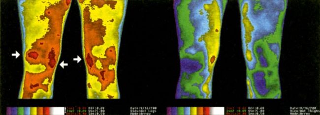 Earthing impact